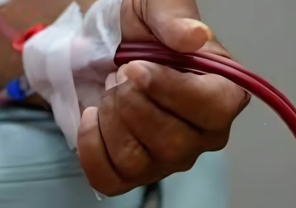 Rising Kidney Disease Among Young Kenyans